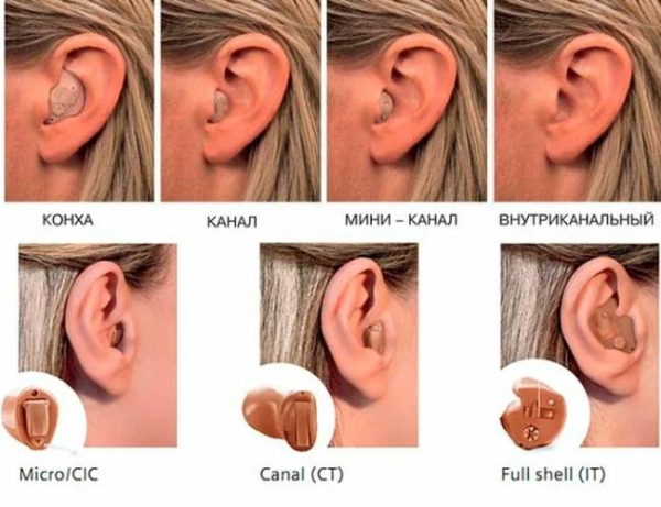 Различные типы слуховых аппаратов